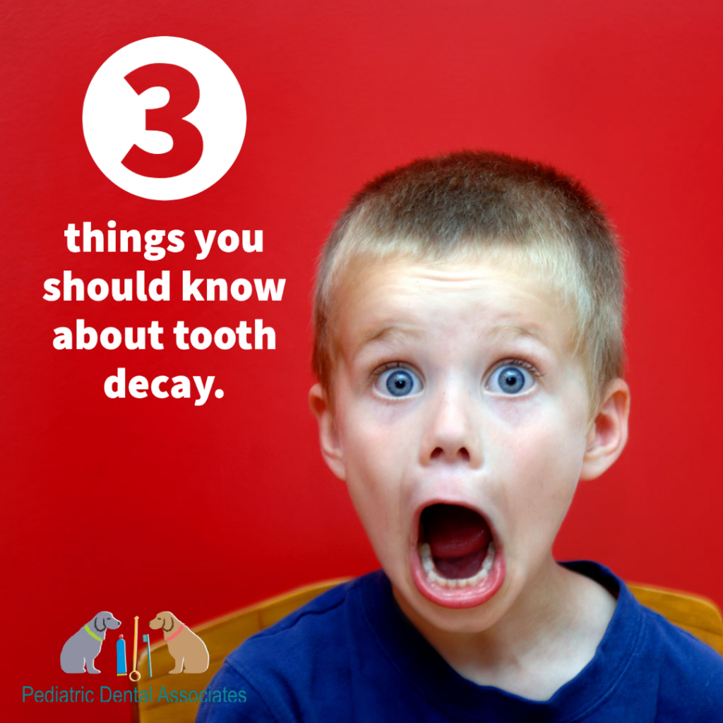 little kid with an open mouth and shocked expression. Red background. Three things to know about tooth decay words to the left